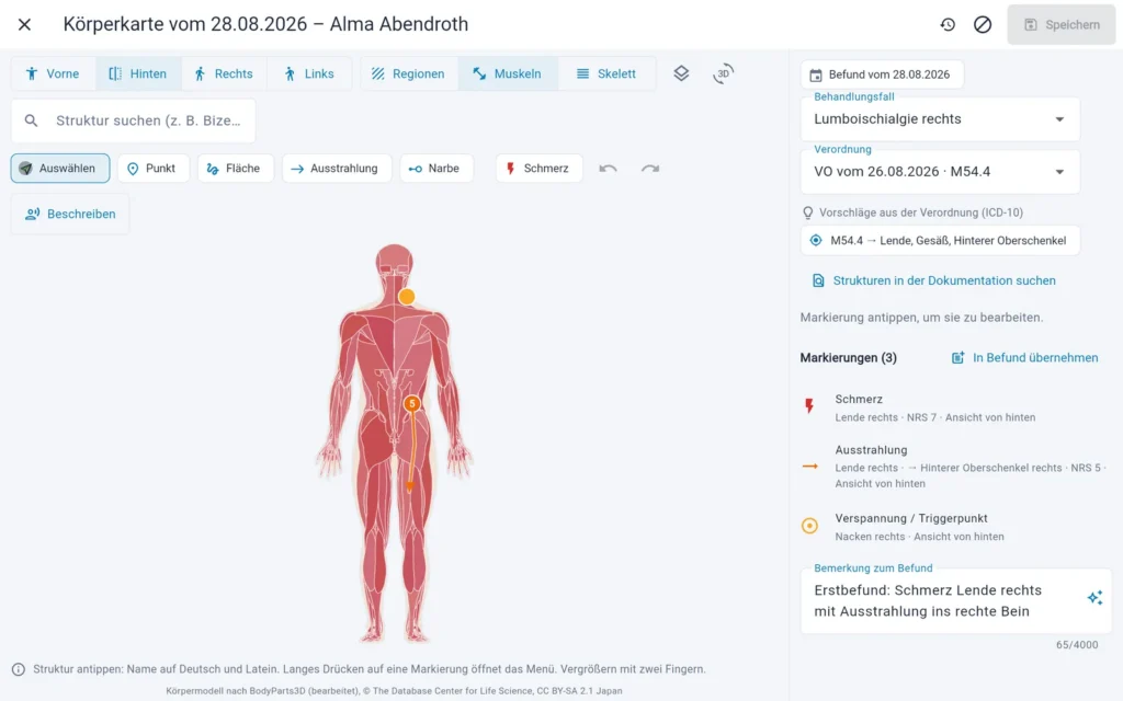 Körperkarte der Physiotherapie-Software Thera X auf dem Tablet im Behandlungsraum